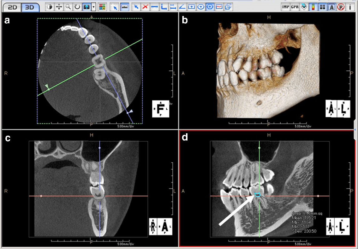 CBCT: Imaging Beyond Dental X-Rays