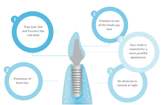 ITS Dental Hospital benefits of dental implants