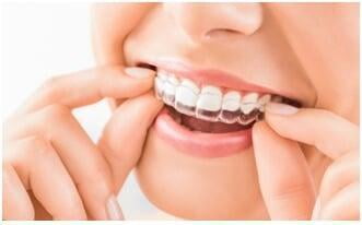 ITS Dental Hospital Clear Aligners