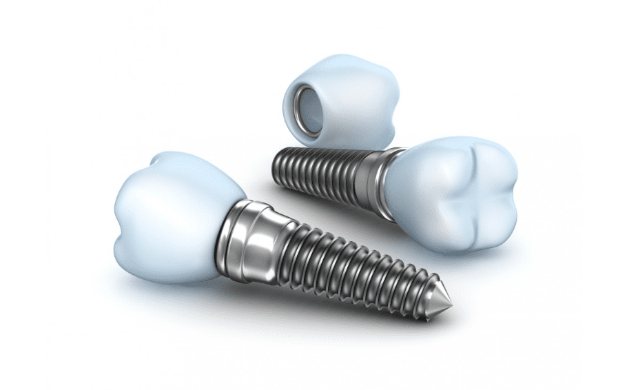 ITS Dental Hospital Dental Implants