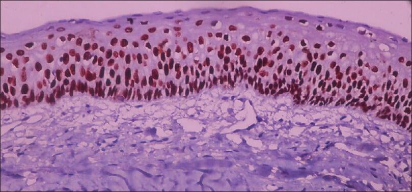 ITS Dental Hospital Special Staining and Advance Molecular Diagnosis