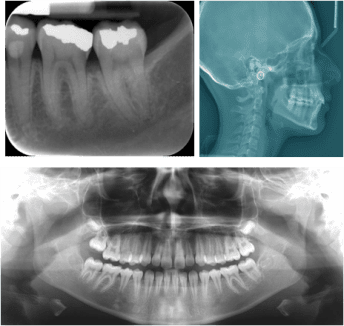 ITS Dental Hospital Oral Medicine, Diagnosis and Radiology
