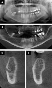 ITS Dental Hospital Periodontology