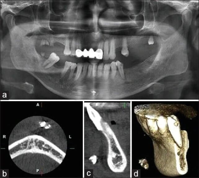 ITS Dental Hospital Dental Surgery