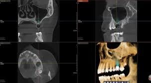 ITS Dental Hospital Advanced Diagnostics