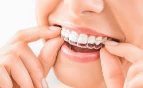 ITS Dental Hospital Clear Aligners