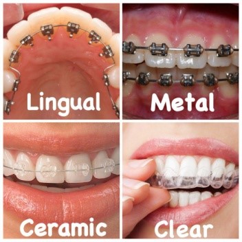 ITS Dental Hospital Orthodontics