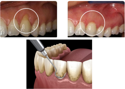 ITS Dental Hospital Periodontics