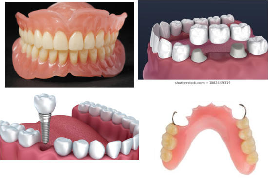 ITS Dental Hospital Prosthodontics